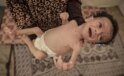 24 saatte 6 kişi daha açlıktan öldü, 7 aylık Salim bebeğin hayatı tehlike altında