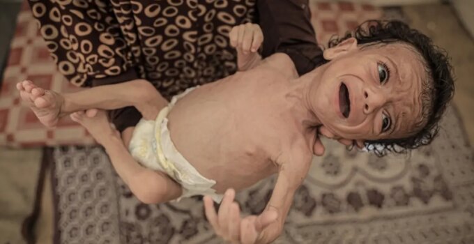 24 saatte 6 kişi daha açlıktan öldü, 7 aylık Salim bebeğin hayatı tehlike altında