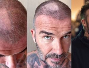 David Beckham’ın tıraş kazası