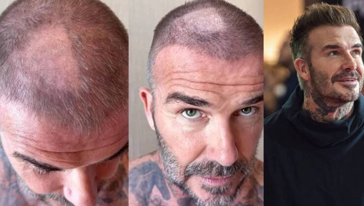 David Beckham’ın tıraş kazası