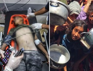İsrail kana doymuyor! Gazze saldırılarında son 24 saatte 89 can kaybı