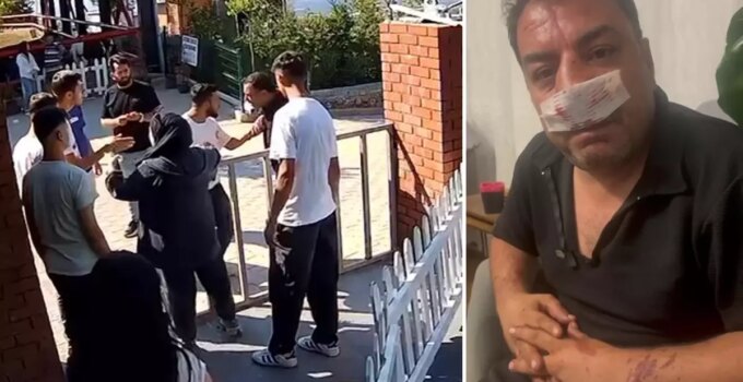 Turistlerden 4 fotoğraf için servet istediler, kavgada araya giren şoförün burnunu kırdılar