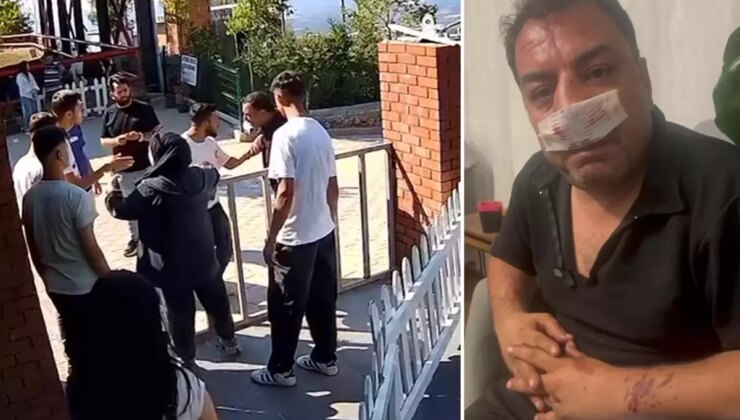 Turistlerden 4 fotoğraf için servet istediler, kavgada araya giren şoförün burnunu kırdılar
