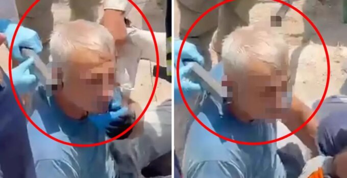 Arkeolojik kazı çalışmalarında başına demir saplanan işçi yaralandı