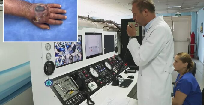 Doktorlar bile şaşırdı! Hırsız elini öyle bir ısırdı ki vaka literatüre girmeye hazırlanıyor