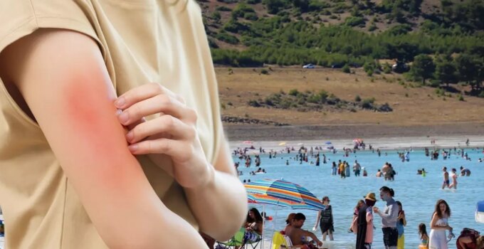 Et yiyen bakteri vakası Türkiye’de görüldü mü? Bakanlıktan açıklama