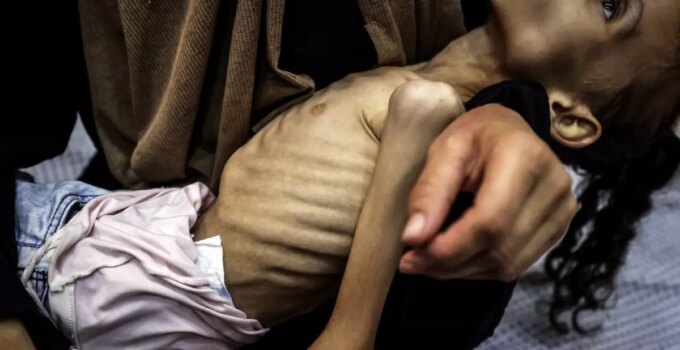 İnsanlığı utandıracak görüntüler! Gazzeli Meryem yavaş yavaş ölüyor