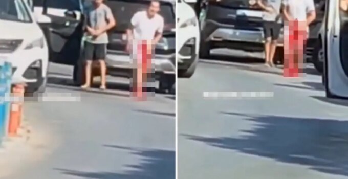 Kavgayı ayırmak isterken silahla vuruldu
