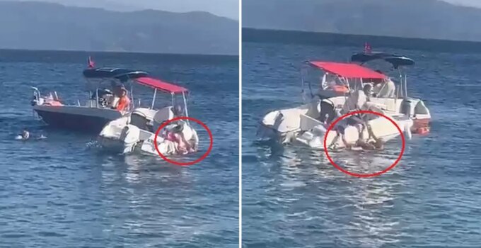 Muhtarın kullandığı sürat teknesi yaşlı kadına çarptı, kemiği kırılıp dışarı çıktı