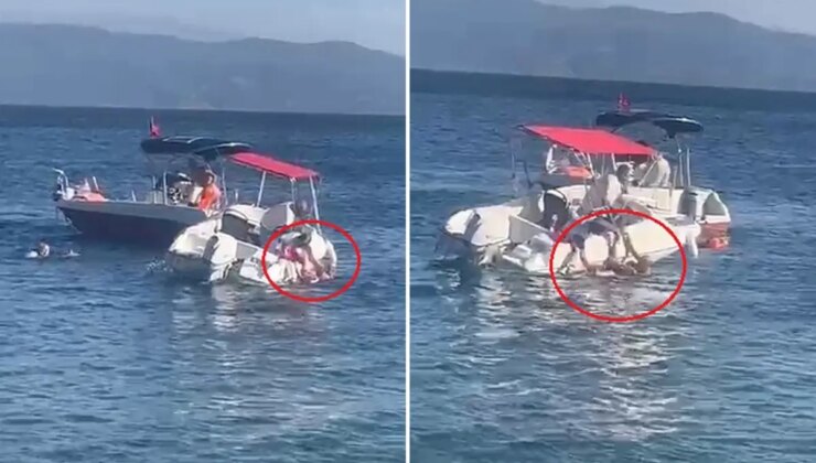 Muhtarın kullandığı sürat teknesi yaşlı kadına çarptı, kemiği kırılıp dışarı çıktı