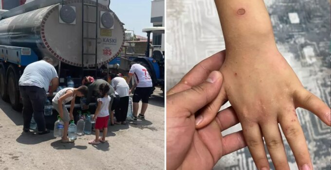 ‘Sular şehri’ Kahramanmaraş’ta 20 gündür süren kriz: İnsanlar tuvaleti gelir diye korkuyor