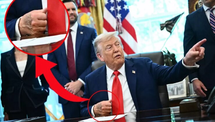 Trump’ın elindeki morluk dikkat çekti, Beyaz Saray "Sık sık el sıkışmaktan" dedi