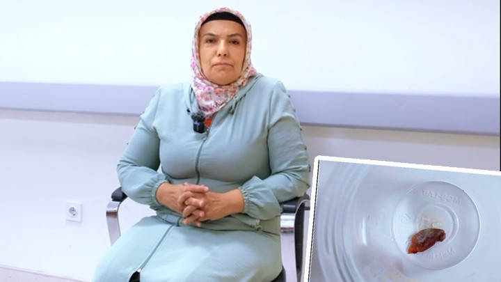 1,5 yıllık öksürüyordu, nedeni kabak çekirdeği çıktı