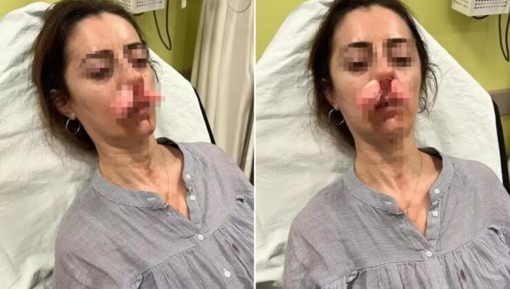 Kocasının sevgilisi zannedip öldüresiye darp etmişti! Arabanın kapısı silah sayıldı