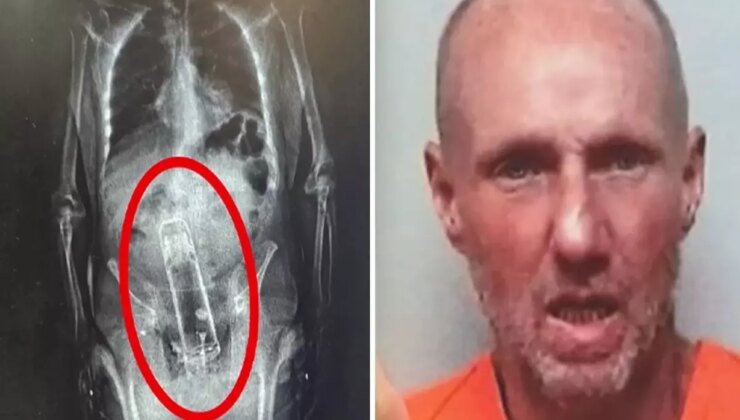 Hapishane girişinde fark edildi! X-Ray’de ortaya çıkan gerçek polislerin ağzını açık bıraktı