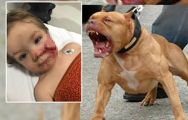 Ankara’da pitbull dehşeti: Çocuğun yüzü paramparça oldu