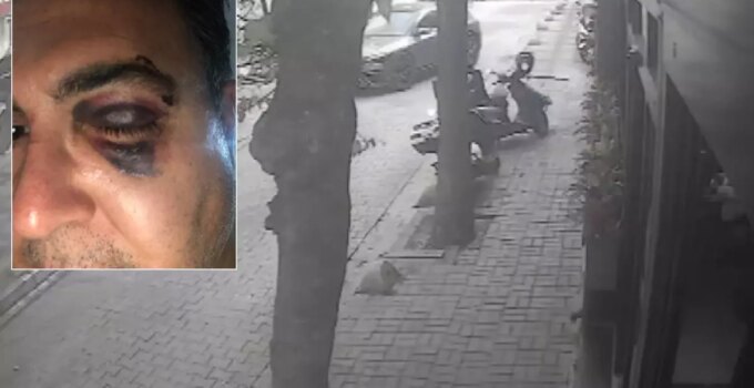 İstanbul’un göbeğinde iş insanına dayak! O anlar kamerada