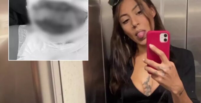 İstanbul’un lüks semtinde bir kadın yakıldı! Tek soru sorup çakmağı çaktı