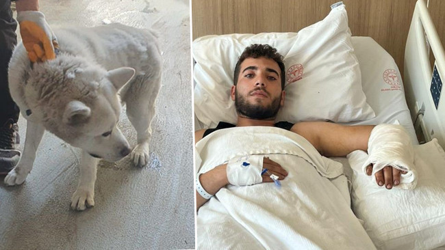 İşyerindeki köpeğin saldırısına uğradı! O anları anlattı: ‘Yemeğini verdiği sırada önce kafamdan sonra kolumdan ısırdı’
