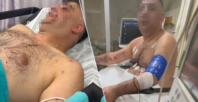 Pompalı tüfekli saldırgan terör estirdi: 1’i polis 4 yaralı