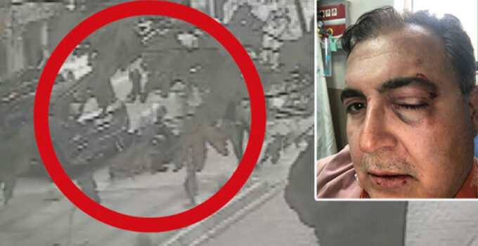 Sokaktaki kedileri besleyen iş insanına feci darp!