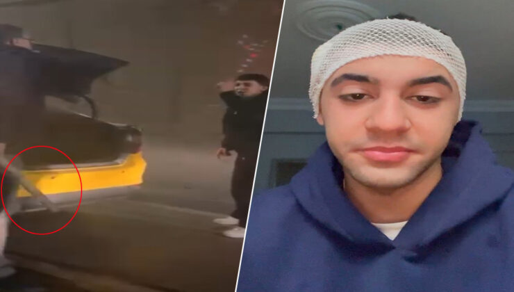 Tartışmaya girdiği taksicisi, motosiklet sürücüsünü sopayla yaraladı