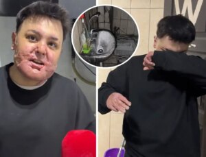 65 ameliyat geçirdi, 12 gün uyutuldu! Hayatı saniyeler içinde kabusa döndü