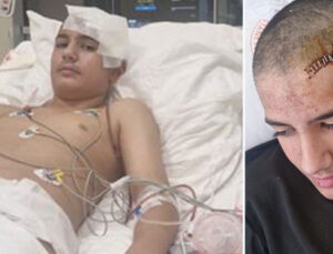 Şakalaştığı arkadaşı taşla kafatasını kırdı!