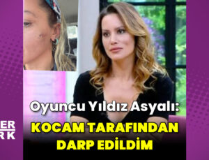 Yıldız Asyalı: Kocam tarafından darp edildim