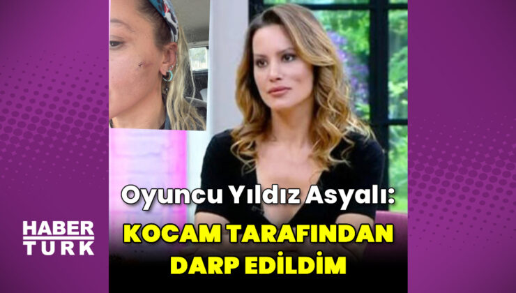 Yıldız Asyalı: Kocam tarafından darp edildim