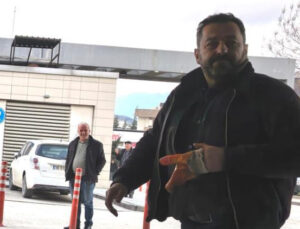 Atölyede feci kaza: İşçinin parmakları koptu