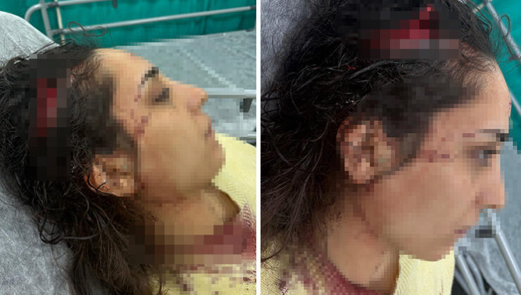 Bakkala giden genç kadın sokak köpeklerinin saldırısına uğradı