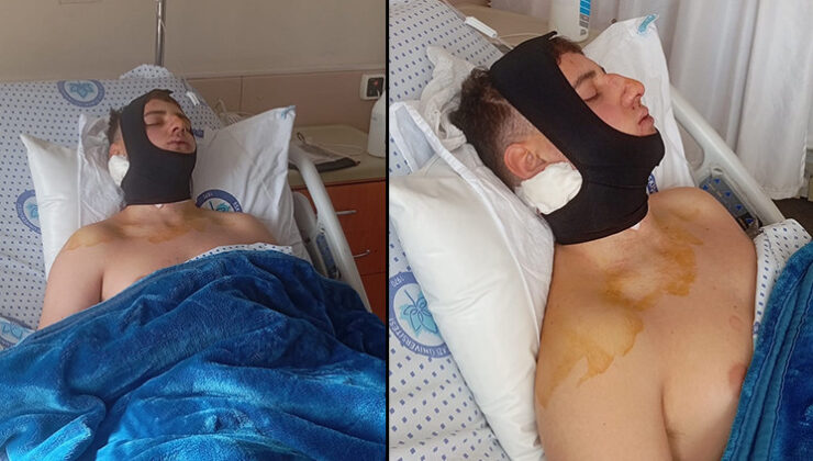 Darbettikleri öğrencinin omuriliğini ve çenesini kıran 4 şüpheli tutuklandı