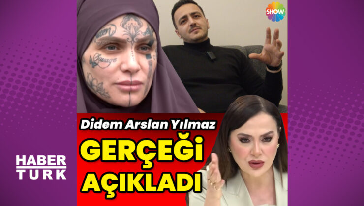 Dövmeleriyle gündeme gelen Nazal Ünal’dan, Burhan Kral’a cevap