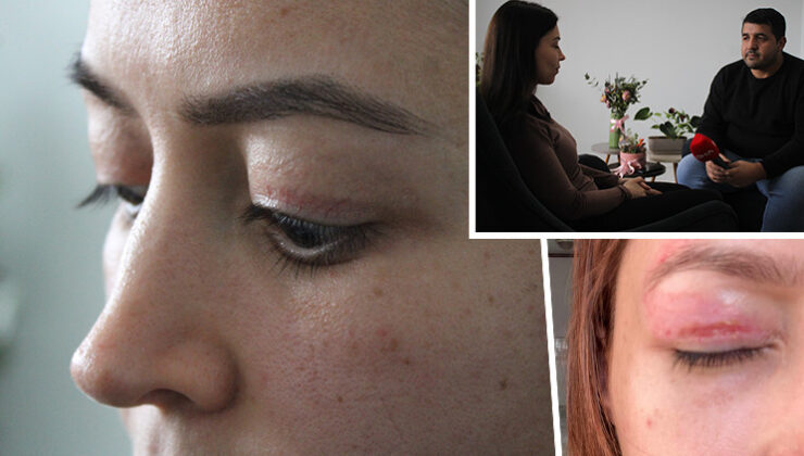 Güzellik salonundaki 1.100 TL’lik işlem genç kadının kabusu oldu: Şikayeti reddedildi | ‘Çevremdekiler fark etti’