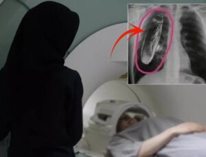 Hastaya "Göğsünde canlı böcek var" dendi, gerçek çok başka çıktı