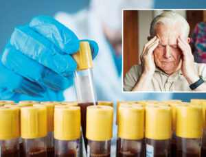Kan testiyle Alzheimer’a erken teşhis