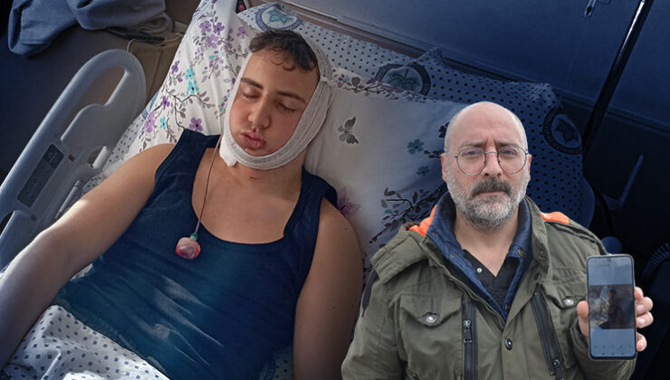 Sınıf arkadaşı ile tartışan genç feci şekilde dövüldü, çenesi ve omuriliği kırıldı: 4 şüpheli tutuklandı