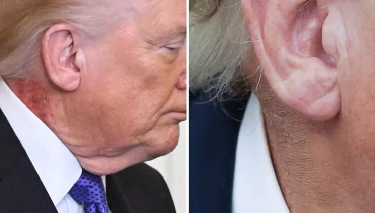 Trump’ın boynundaki kızarıklığı gizleme çabası